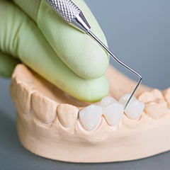 Model smile with dental bridge