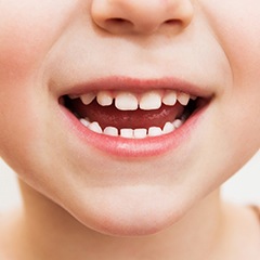 Closeup of child's healthy smile