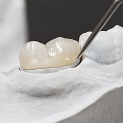 Model smile with dental crown restoration