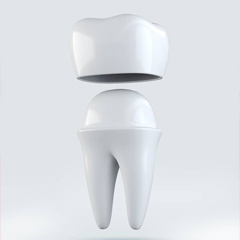 dental crown