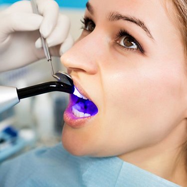 young woman getting her tooth-colored fillings in Sunnyvale hardened with curing light 