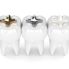 one tooth with gold filling, one with silver filling, and one with composite filling 