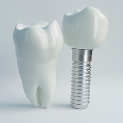 dental implant with crown next to a natural tooth