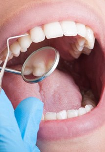 patient getting dental checkup in Mesquite