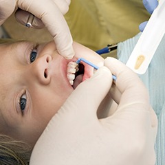 Child receiving fluoride treatment