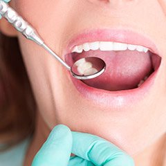 Closeup of smile during dental exam