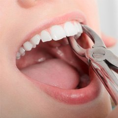 A dentist pulling a patient’s tooth