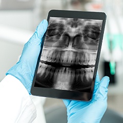 Digital x-rays on tablet computer screen