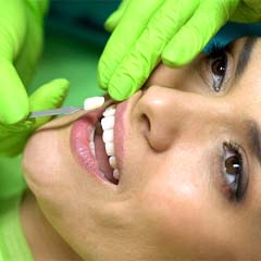 Woman getting dental veneers in Sunnyvale