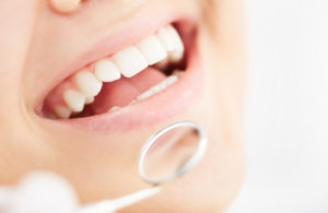 close-up of a smile at the dentist's