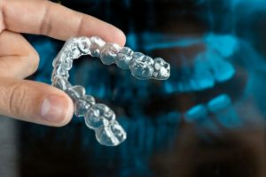 close up of hand holding aligner for Invisalign in Sunnyvale
