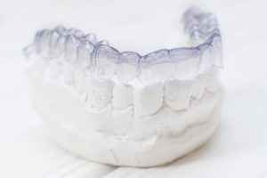 Dental model of Invisalign in Sunnyvale.