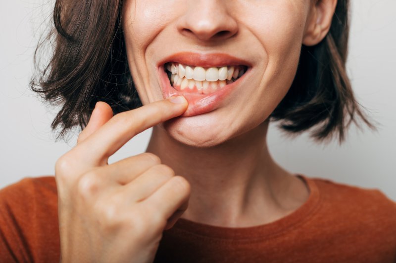 Lady shows gum disease